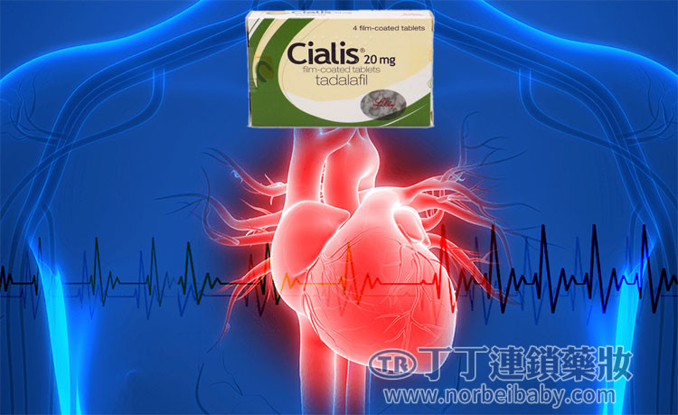 心臟病可以服用犀利士嗎